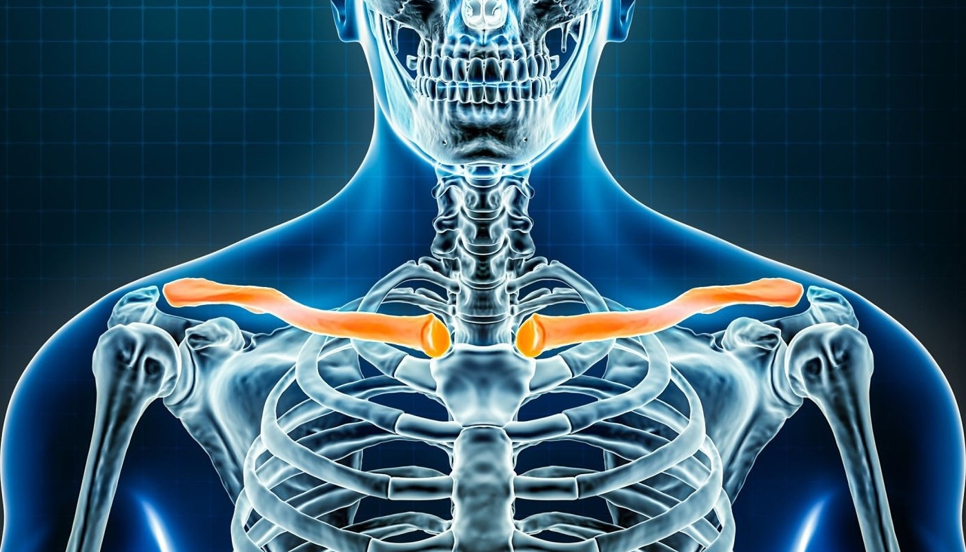 clavicle disorders