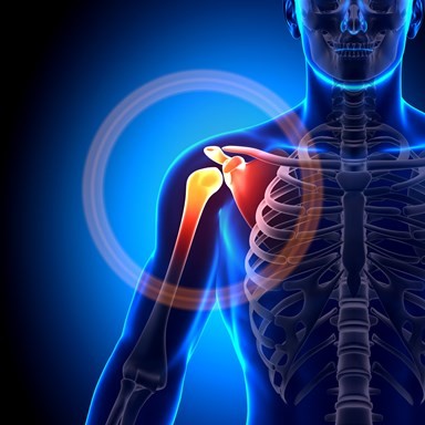 Shoulder Impingement